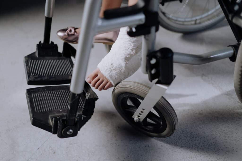 Qu’est-ce qu’une fracture de la jambe ?